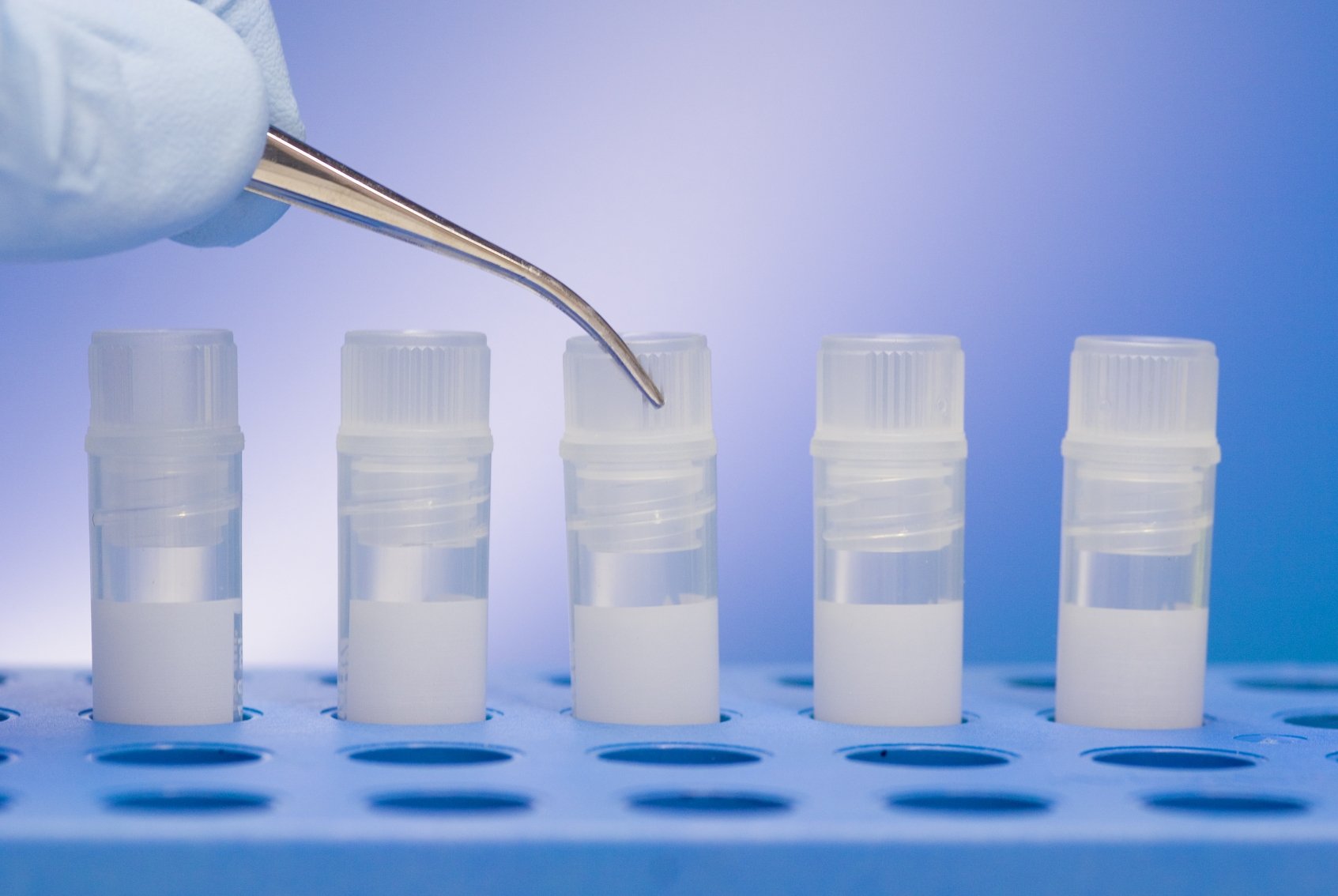 3 Key Trends You Must Know to Profit from Stem Cell Products
