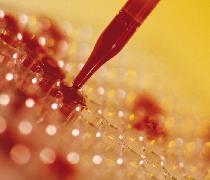 Top 10 Diagnostics Sectors that will Boom in the Next 5 Years