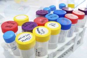 Growing In-Vitro Diagnostics (IVD) Markets in Asia